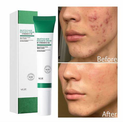 CREMA PERFILADORA ACIDO SALICILICO BIOAQUA